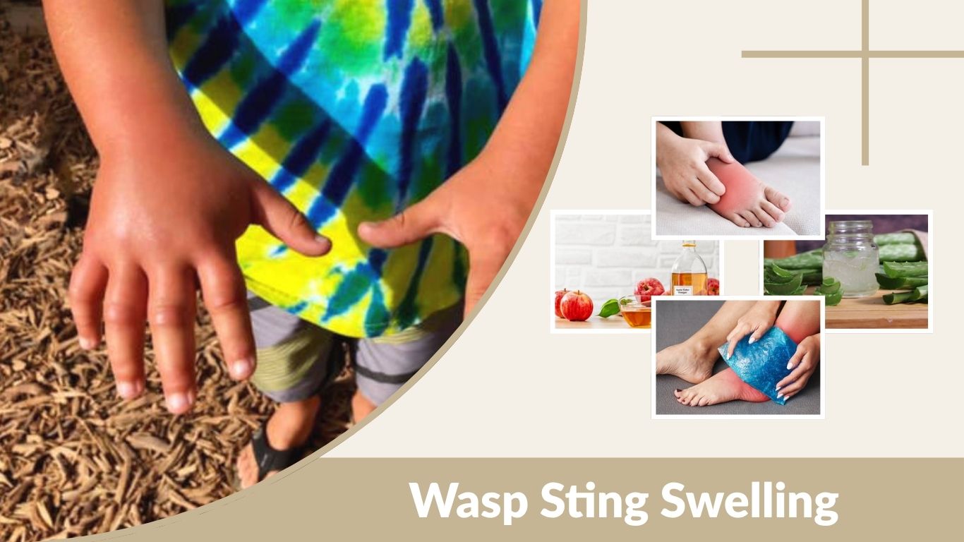 Wasp Sting Swelling After 48 Hours: Should You Worry? 