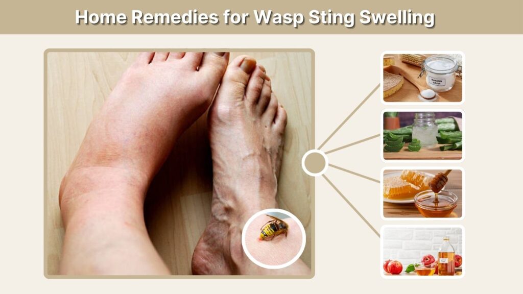 Home Remedies for Wasp Sting Swelling