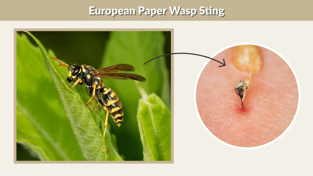 European Paper Wasp Sting