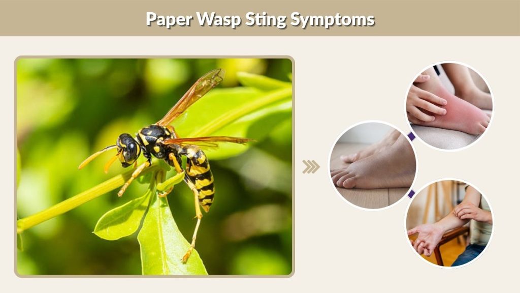 Paper Wasp Sting Symptoms
