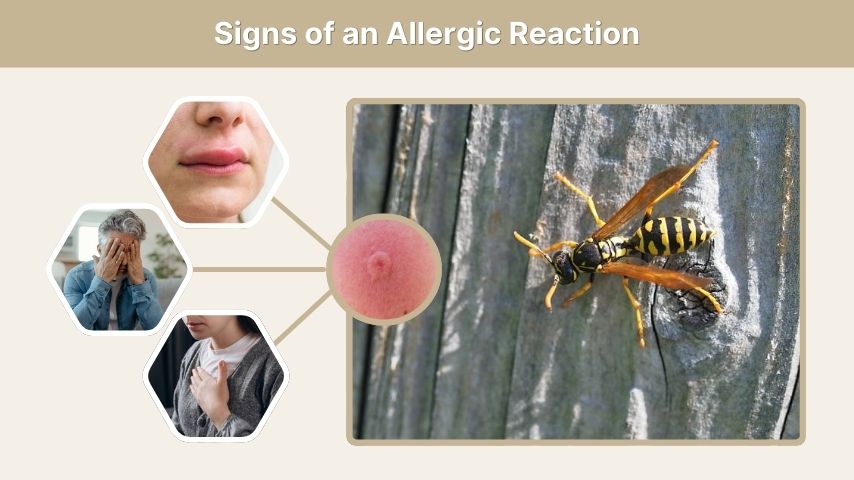 Signs of an Allergic Reaction