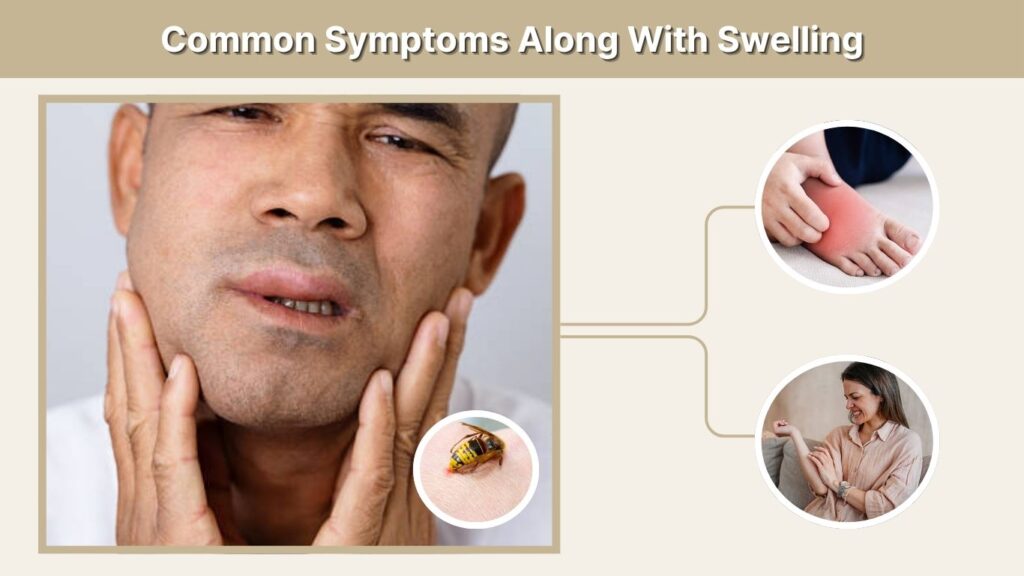 Common Symptoms Along With Swelling