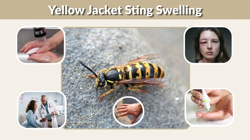 Yellow Jacket Sting Swelling: Causes, Relief, and Warning Signs