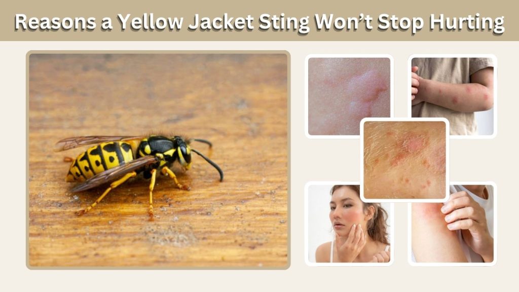 Reasons a Yellow Jacket Sting Won’t Stop Hurting