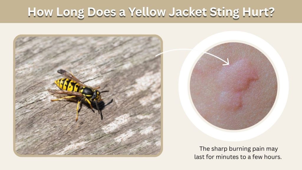 How Long Does a Yellow Jacket Sting Hurt?