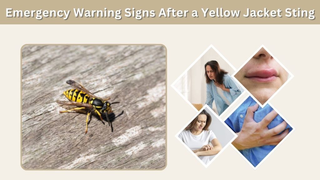 Emergency Warning Signs After a Yellow Jacket Sting