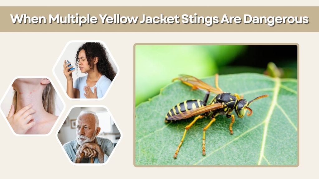 When Multiple Yellow Jacket Stings Are Dangerous
