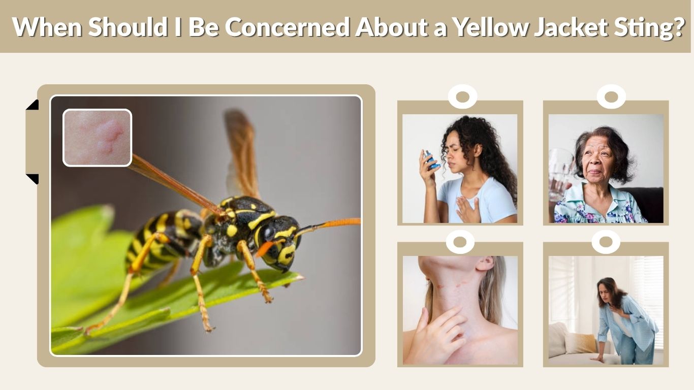When Should I Be Concerned About a Yellow Jacket Sting?