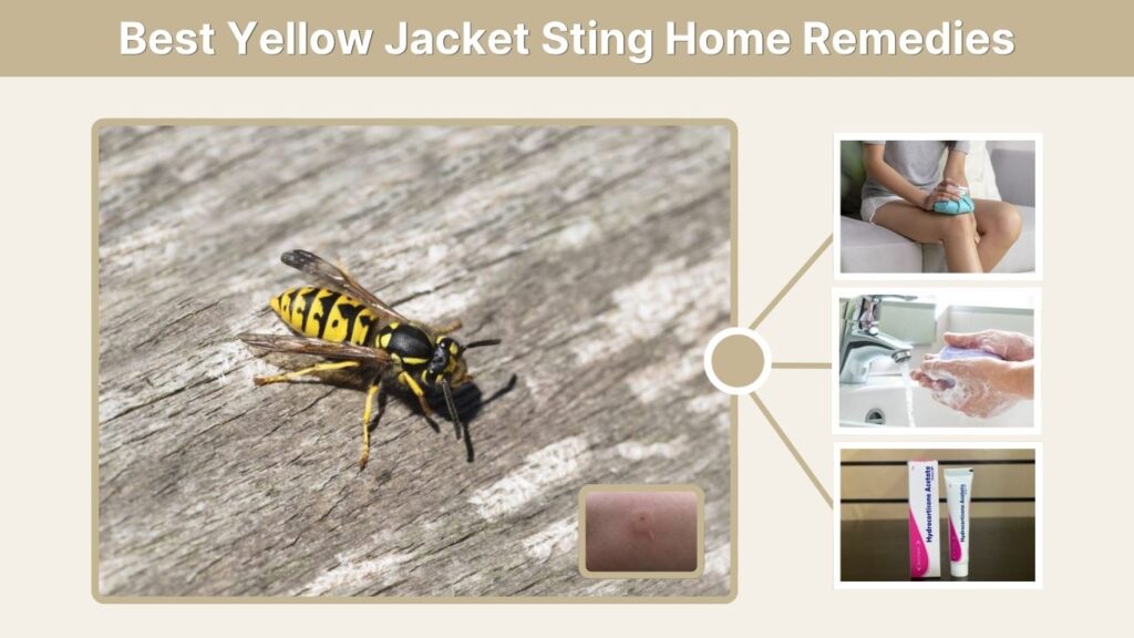 Best Yellow Jacket Sting Home Remedies