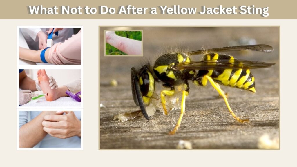 What Not to Do After a Yellow Jacket Sting