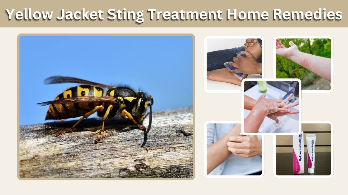 Yellow Jacket Sting Treatment Home Remedies: What Works Safely 