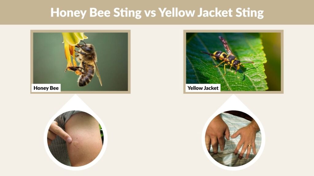 Honey Bee Sting vs Yellow Jacket Sting