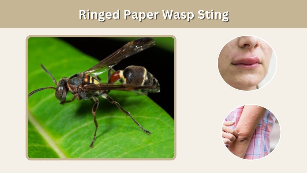 Ringed Paper Wasp Sting