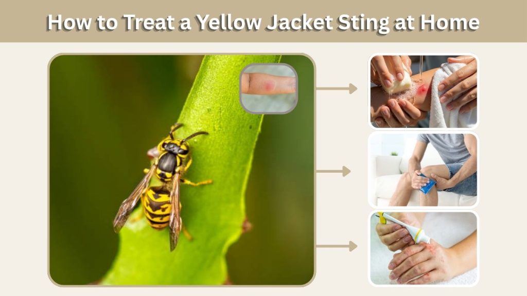 How to Treat a Yellow Jacket Sting at Home