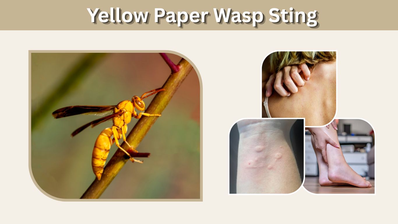 Yellow Paper Wasp Sting: Symptoms, Treatment and Pain
