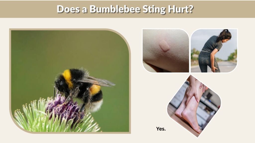 Does a Bumblebee Sting Hurt?