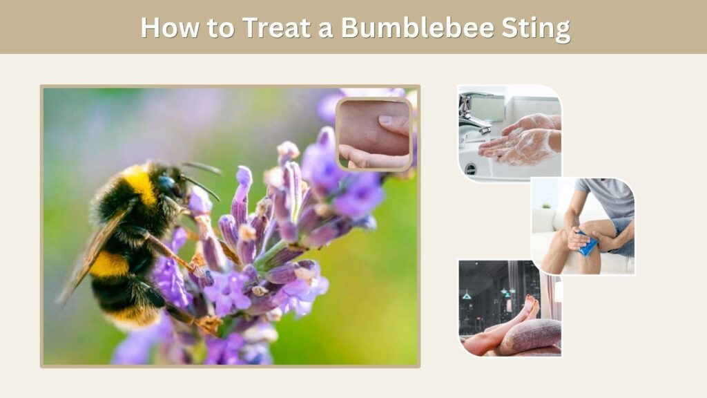 How to Treat a Bumblebee Sting