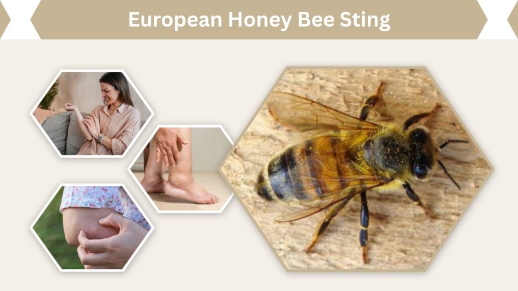 European Honey Bee Sting