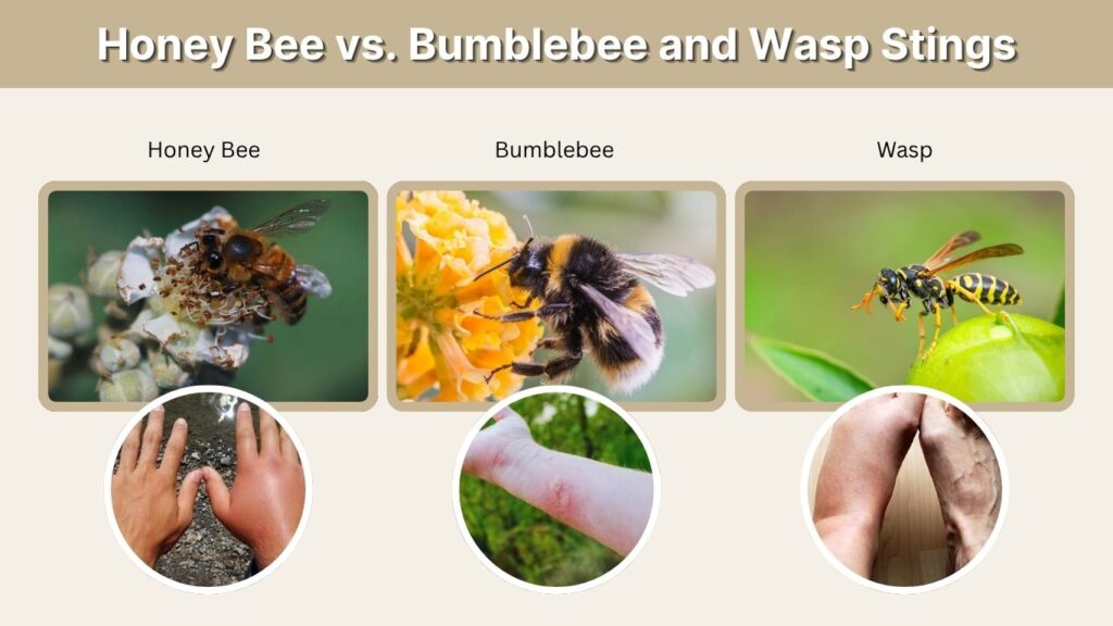 Honey Bee vs. Bumblebee and Wasp Stings
