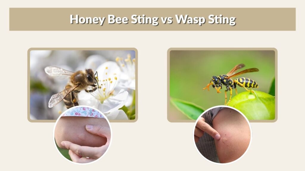 Honey Bee Sting vs Wasp Sting